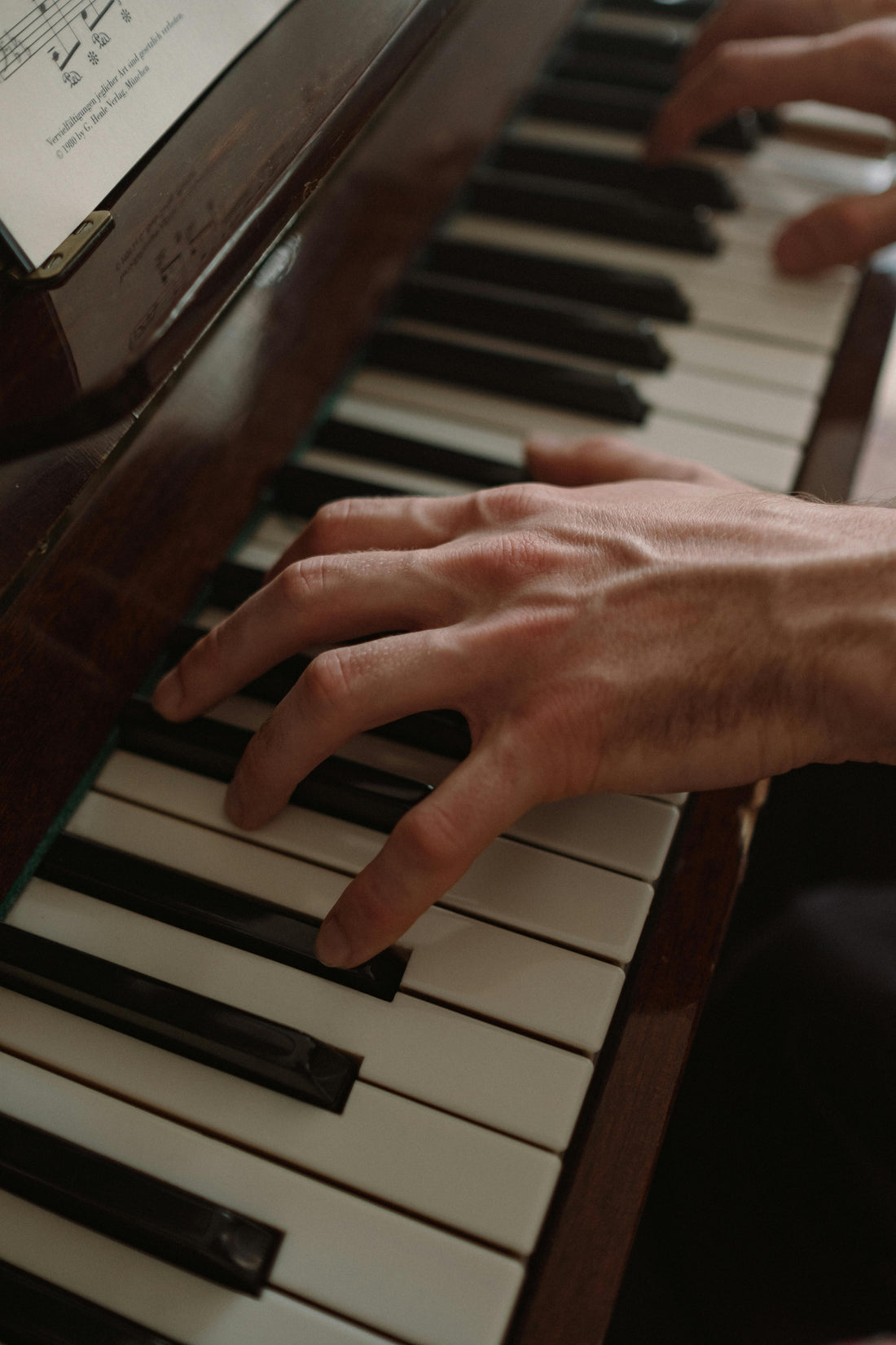 Bulging Veins on Hands: Causes, Treatment, and Meaning