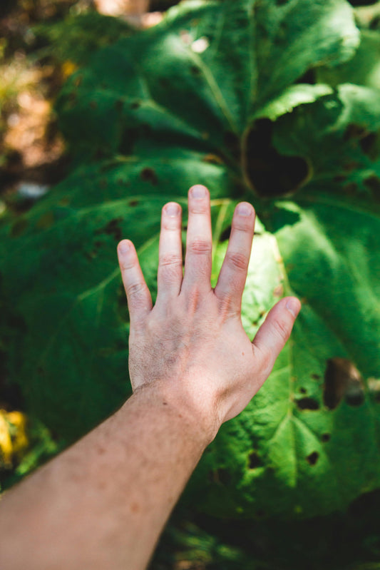 How Can I Stop Spider Veins? A Vein Doctor Explains Everything