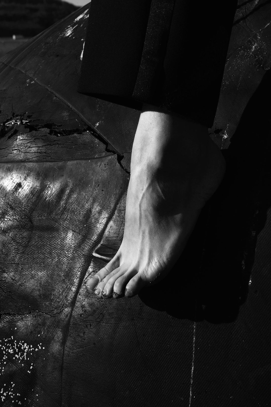 Are Spider Veins on Feet Dangerous?