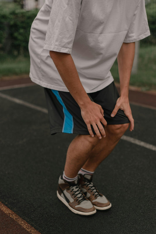 How to Get Rid of Varicose Veins Naturally